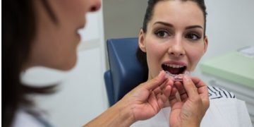 Can dental implants be done if I have a history of allergies?