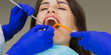 Unveiling Perio Plastic: A Comprehensive Guide to Periodontal Plastic Surgery