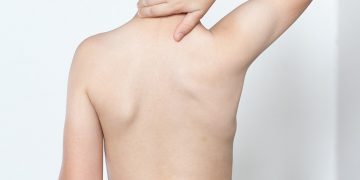 Pediatric Shoulder Conditions: Specialized Care in Athens, Alabama