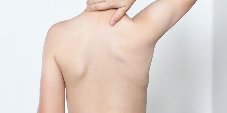 Pediatric Shoulder Conditions: Specialized Care in Athens, Alabama