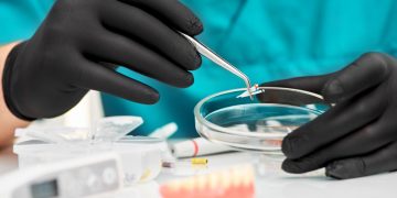 Why Dentists Lean Towards Root Canal Treatment