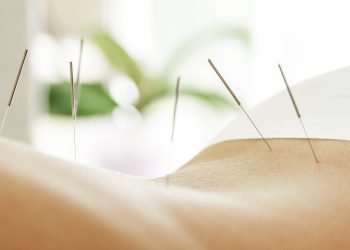 Discovering the Right Acupuncture Clinic for Effective Pain Relief