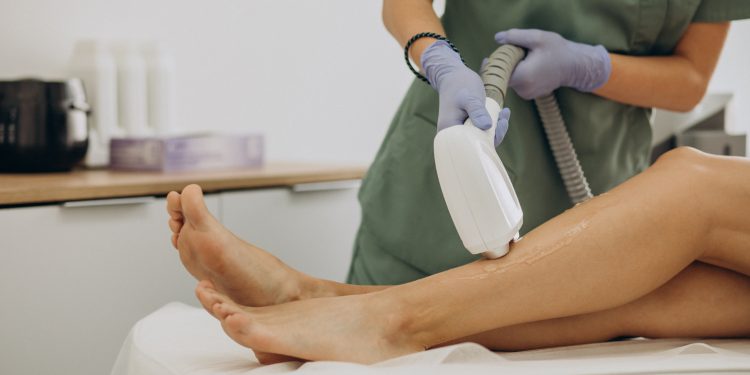 Is Laser Hair Removal a Good Idea?